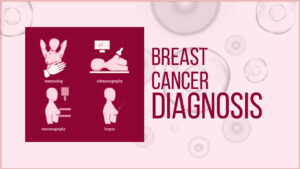 Breast cancer misdiagnosis lawyer upstate new york